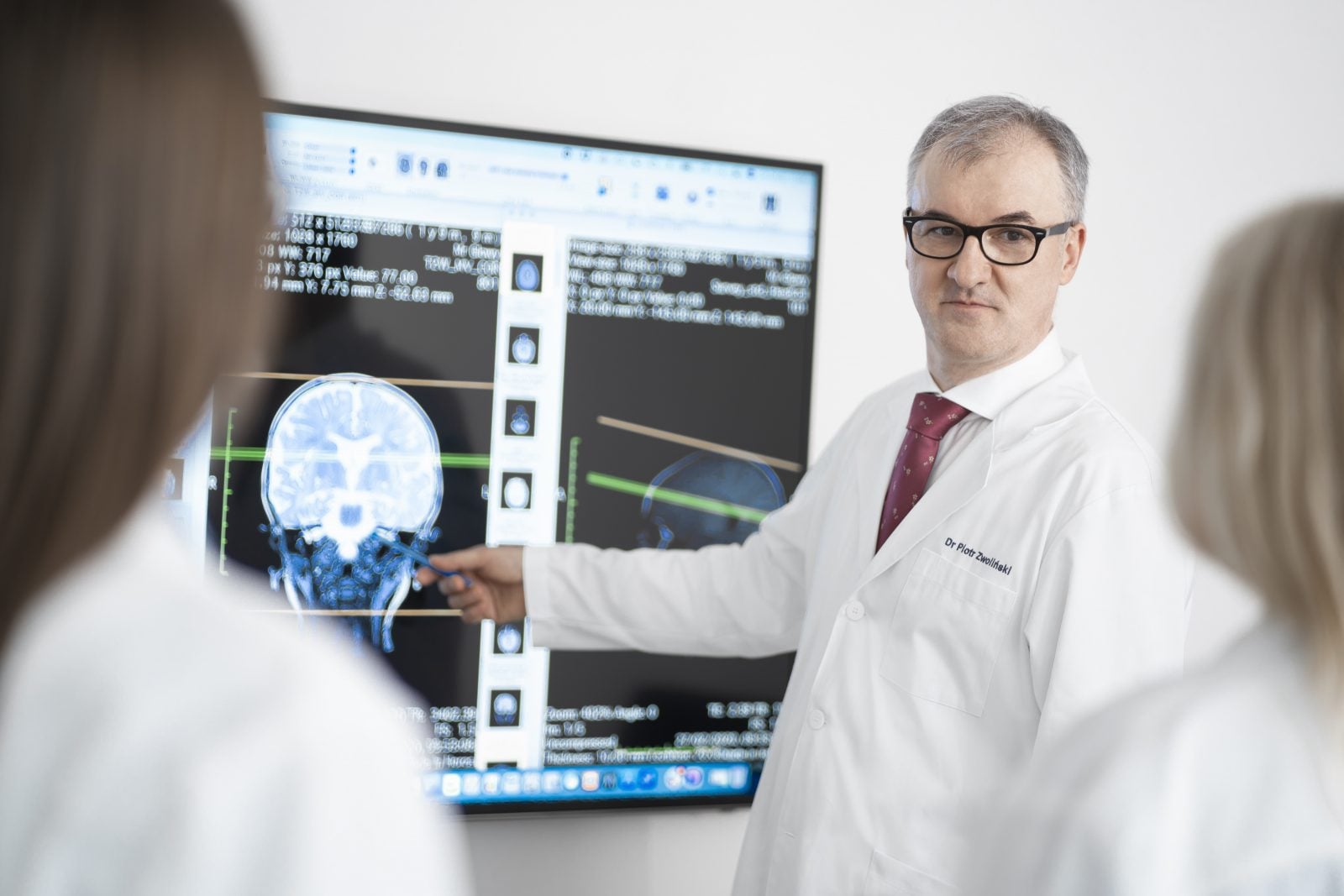 Robot zdiagnozuje padaczkę. Niezwykły wynalazek Polaków