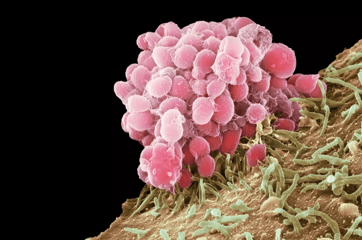 Neisseria gonorrhoeae