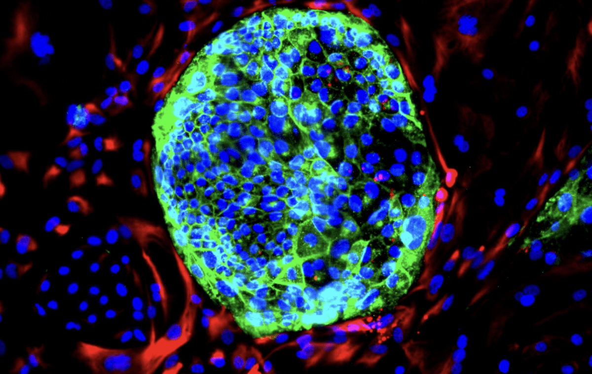 Zdjęcie nowych komórek &#8211; komórek mezodermy pozazarodkowej (czerwone) i komórek macierzystych łożyska (zielone) /Fot. KU Leuven
