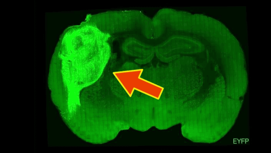 Ludzkie organoidy wbudowane w mózg szczura /Fot. Stanford Medicine
