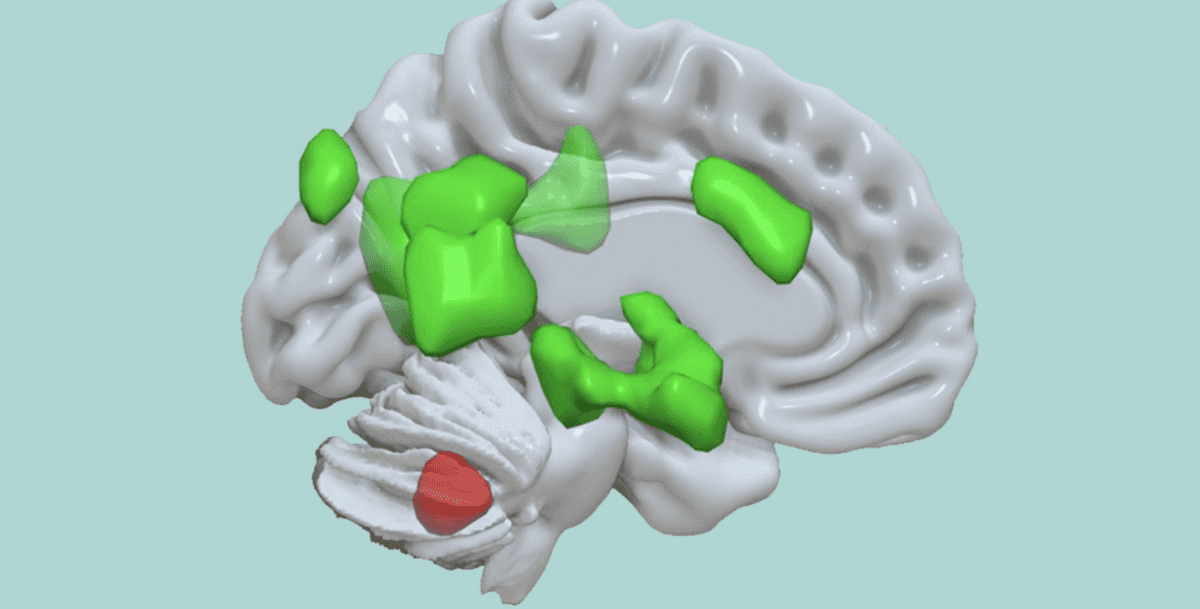 Móżdżek (czerwony) łączy się z różnymi rejonami mózgu (zielony) wzmacniającymi przechowywanie informacji emocjonalnych /Fot. University of Basel
