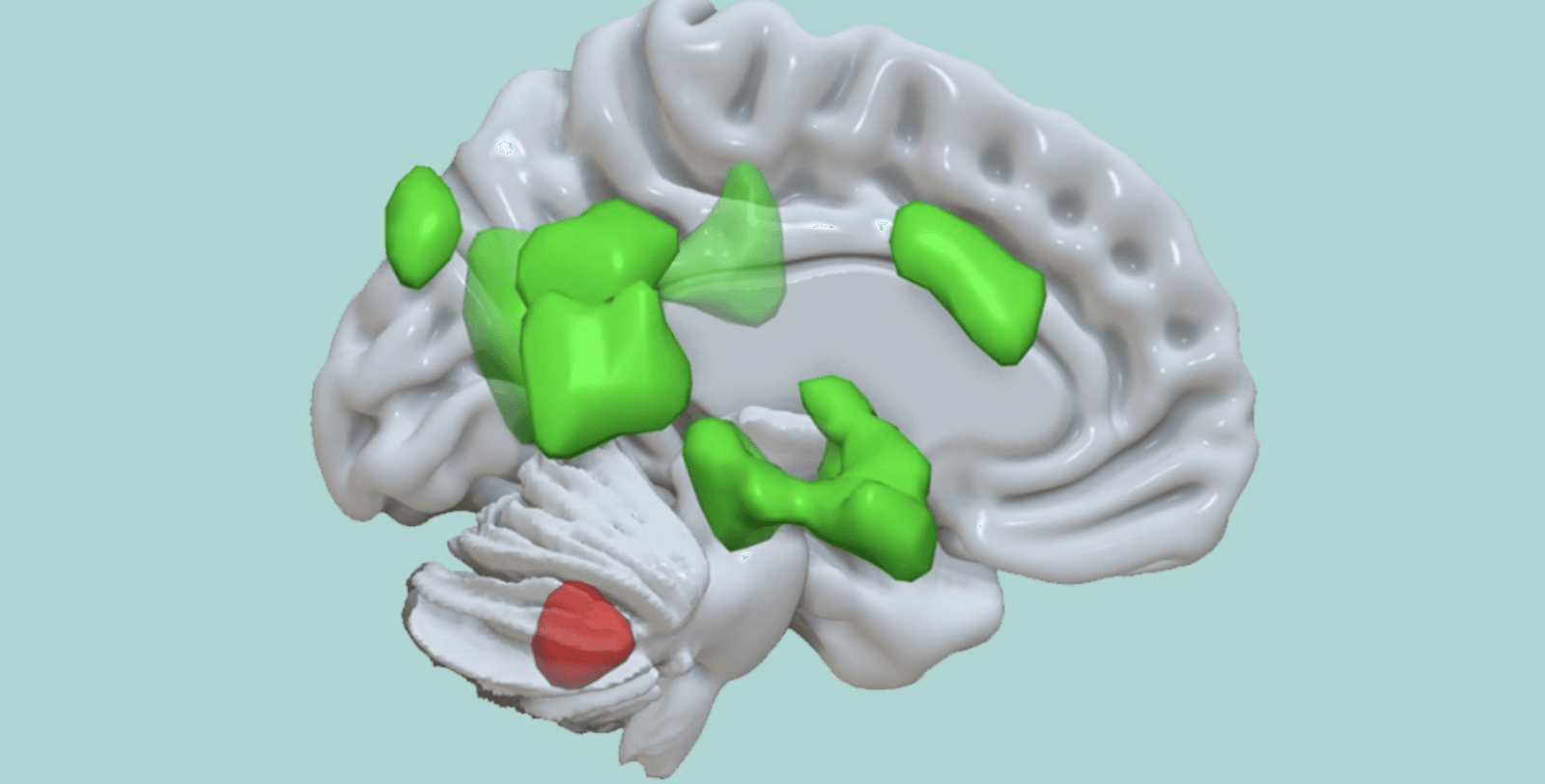 Móżdżek (czerwony) łączy się z różnymi rejonami mózgu (zielony) wzmacniającymi przechowywanie informacji emocjonalnych /Fot. University of Basel
