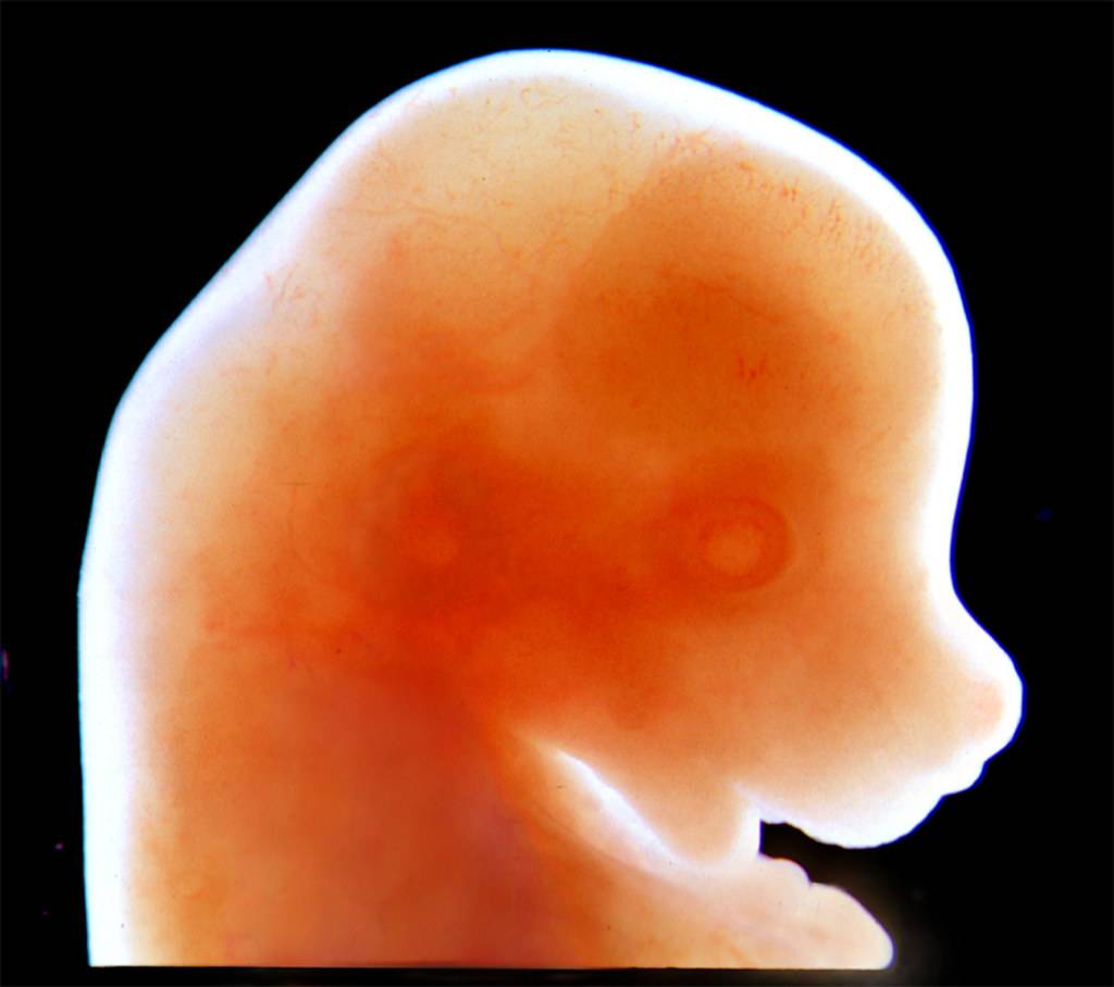 Ludzkie zarodki będą hodowane w mechanicznych macicach. Pomysłodawcy odnieśli już pierwsze sukcesy