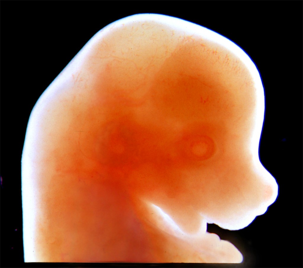 Ludzkie zarodki będą hodowane w mechanicznych macicach. Pomysłodawcy odnieśli już pierwsze sukcesy