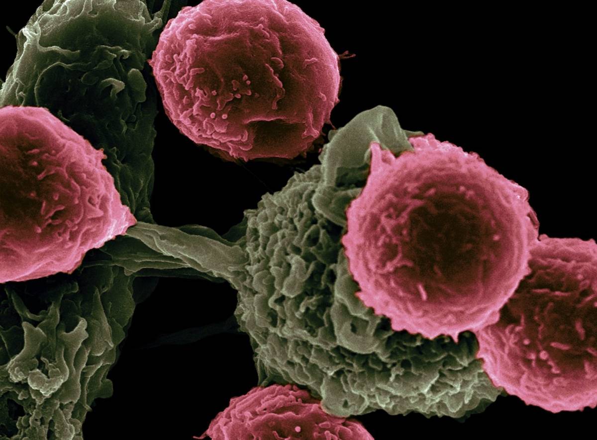 Komórki nowotworowe ostrzegają się nawzajem /Fot.
National Cancer Institute, Unsplash
