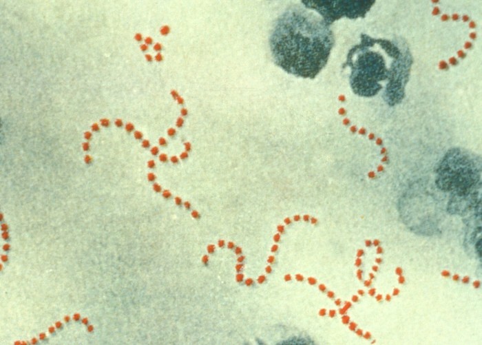 Bakterie Streptococcus pyogenes /Fot. Wikimedia Commons
