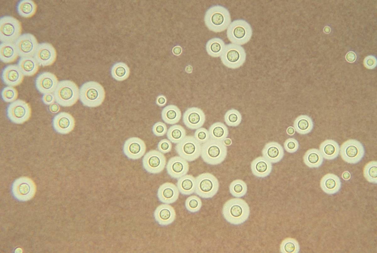 Grzyb Cryptococcus neoformans /Fot. Duke University
