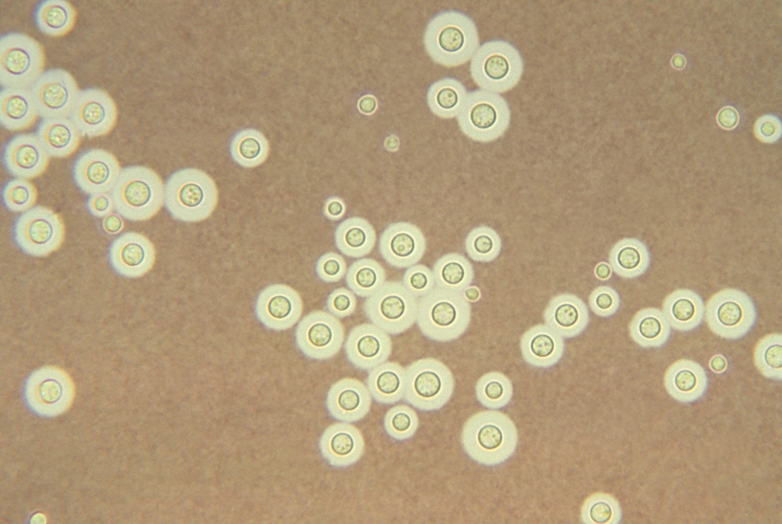 Grzyb Cryptococcus neoformans /Fot. Duke University
