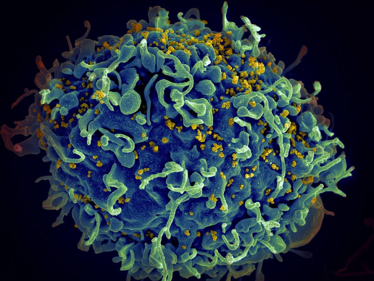 HIV (na żółto) atakujący ludzką komórkę /Fot. National Cancer Institute, Unsplash

