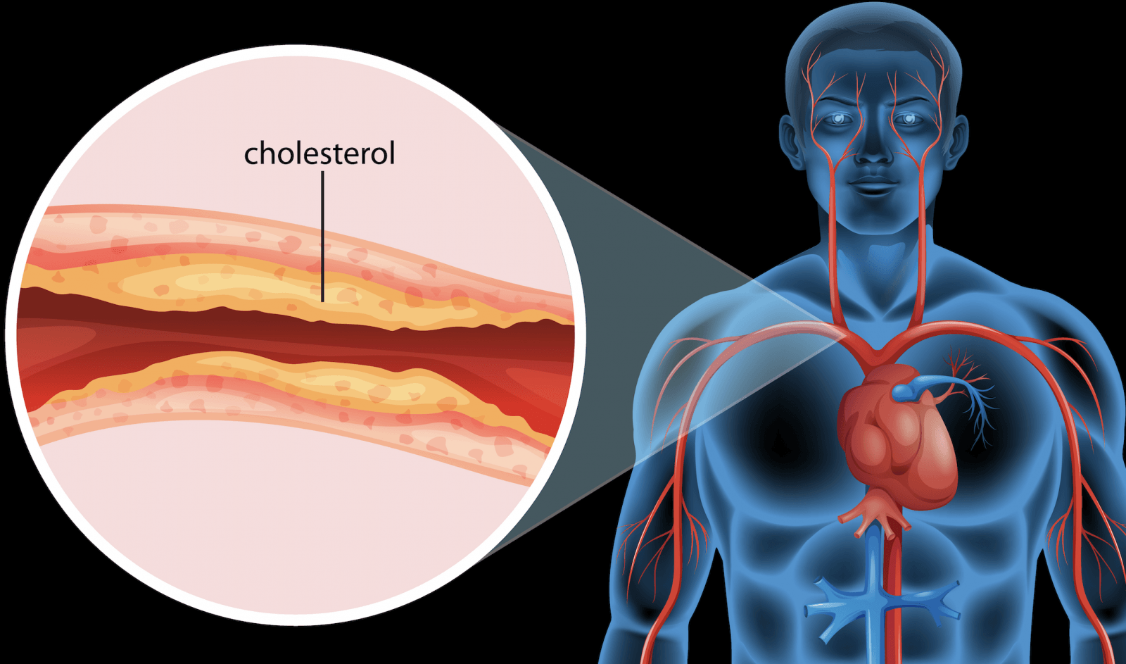 Cholesterol &#8211; zdjęcie poglądowe /Fot. brgfx, Freepik
