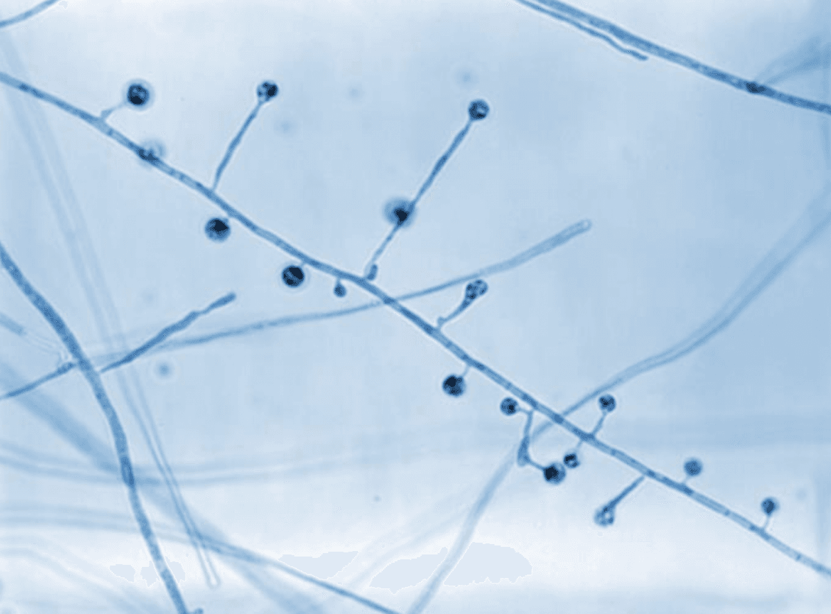 Blastomyces dermatitidis pod powiększeniem 800x &#8211; widoczne liczne konidiofory (szczytowe strzępki grzybni) /Fot. CDC

