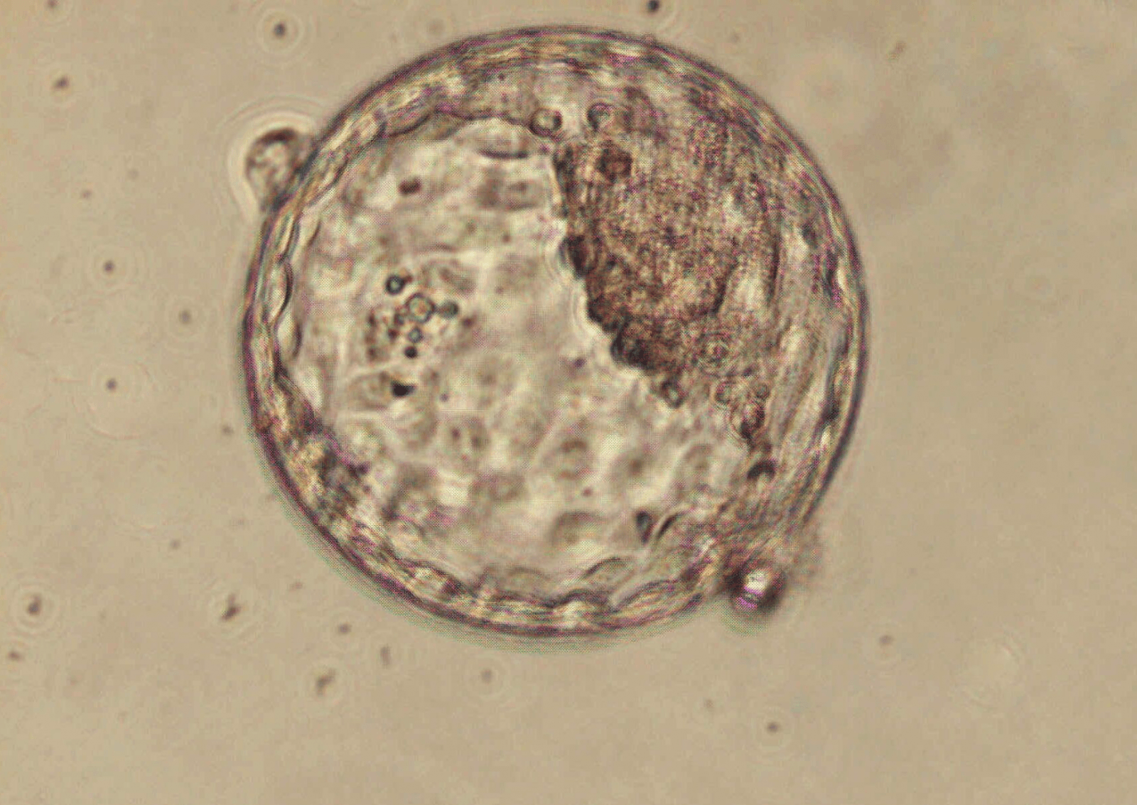 Ludzka i małpia blastocysta nie różnią się znacznie od siebie /Fot. CC BY 4.0