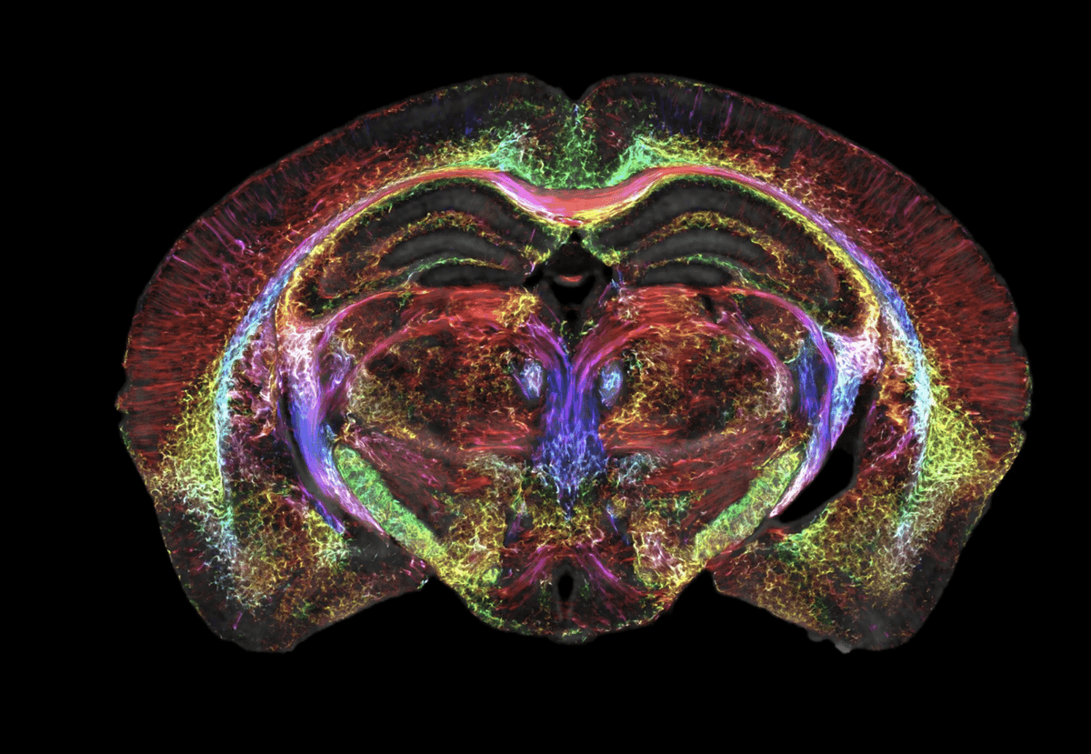 Rezonans magnetyczny będzie jeszcze dokładniejszy &#8211; skan mózgu myszy otrzymany nową metodą /Fot. Duke University
