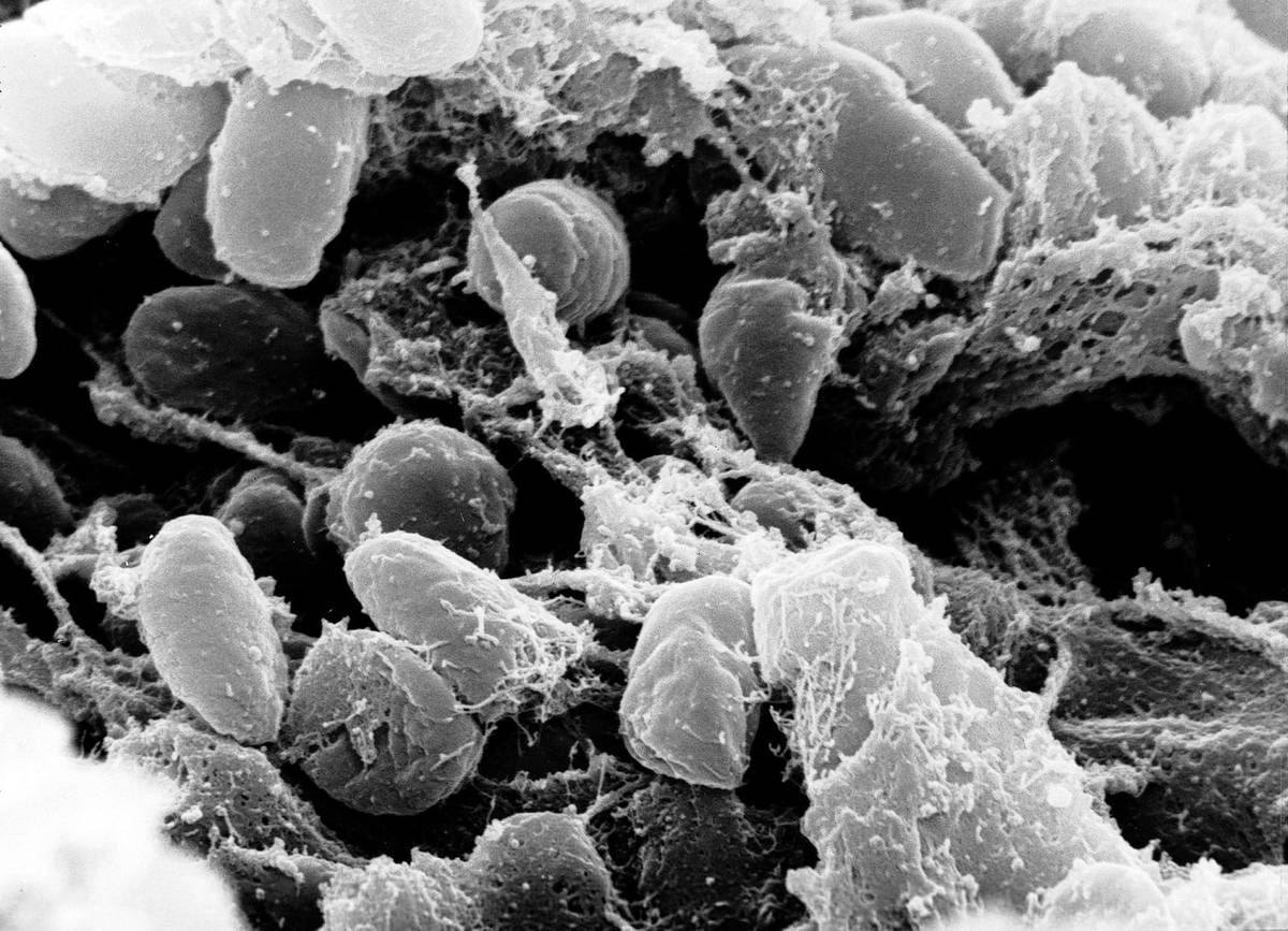 Śmiercionośny patogen znaleziony w grobie sprzed niemal 5 tysięcy lat. To on mógł wywołać pierwszą znaną pandemię
