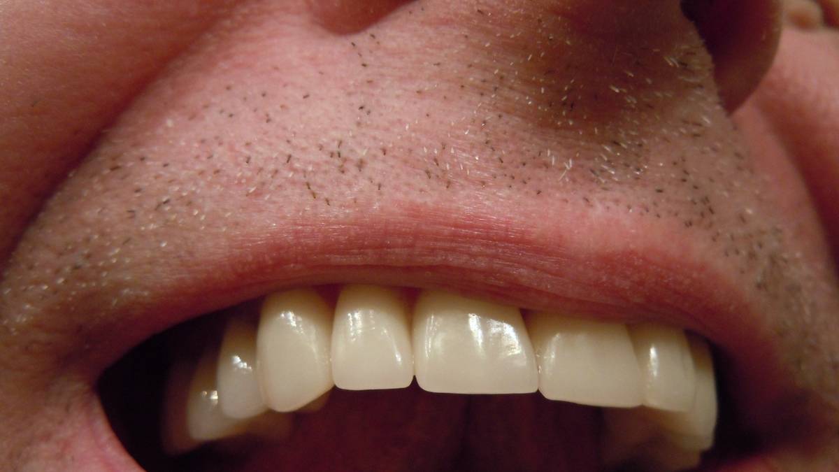 Dlaczego ludzie mieli dawniej inne zęby?