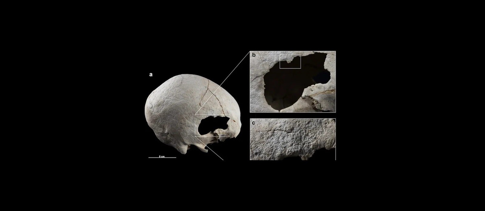 Prehistoryczne operacje czaszki. Zagadkowe szczątki znalezione w Europie