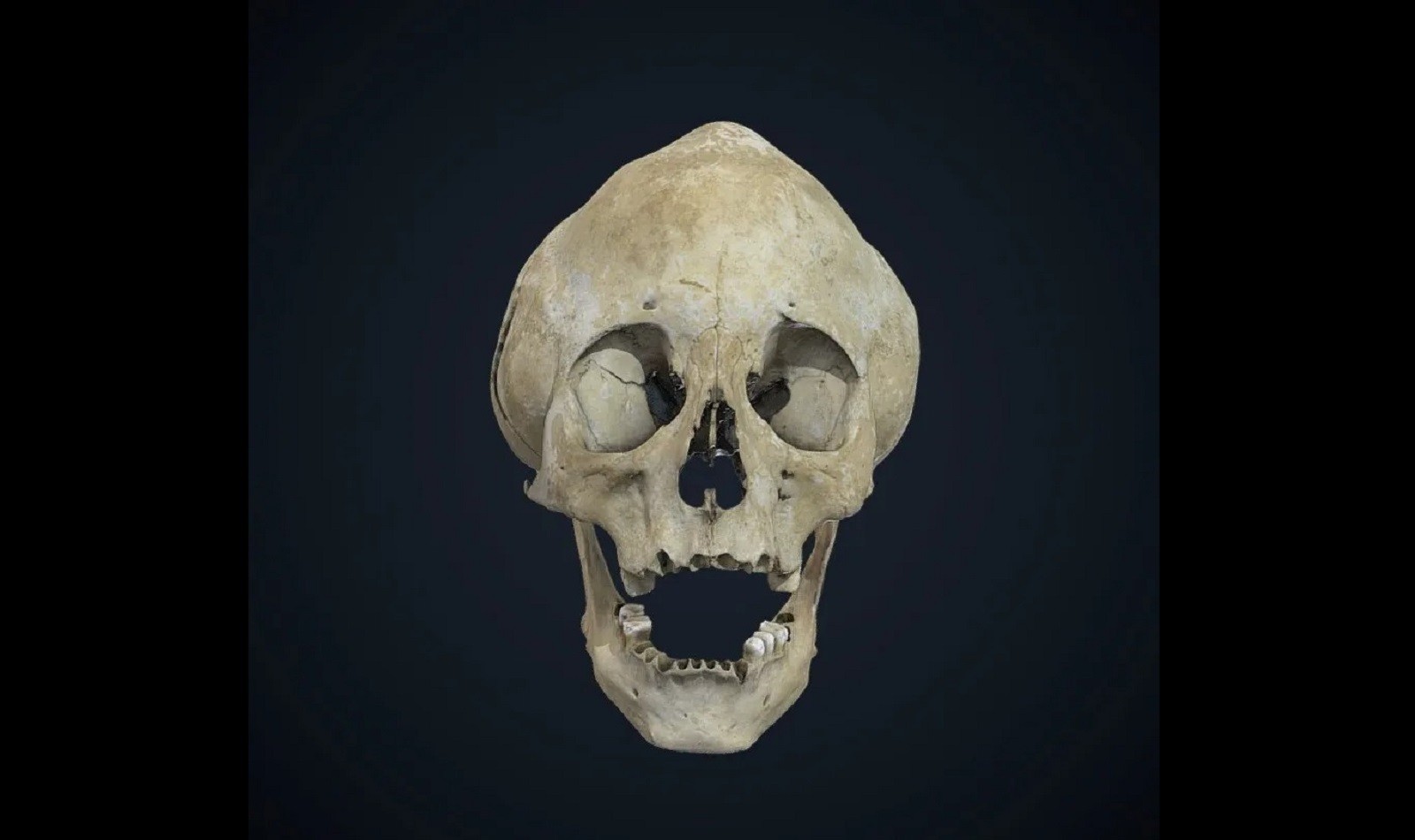 Spiczasta głowa i wyłupiaste oczy. Zadziwiające szczątki znalezione w Boliwii