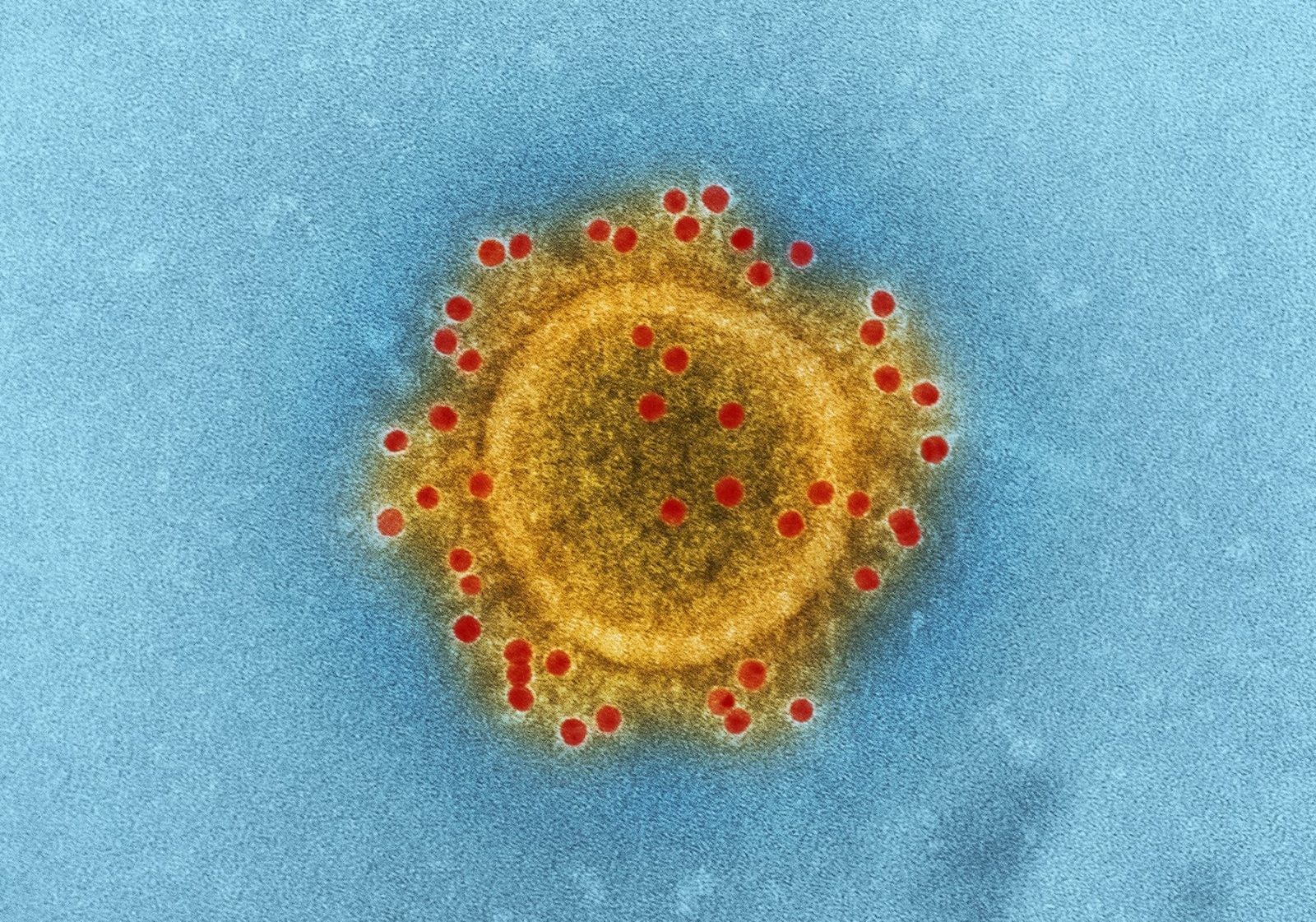 Wirus &#8211; zdjęcie poglądowe /Fot. CDC
