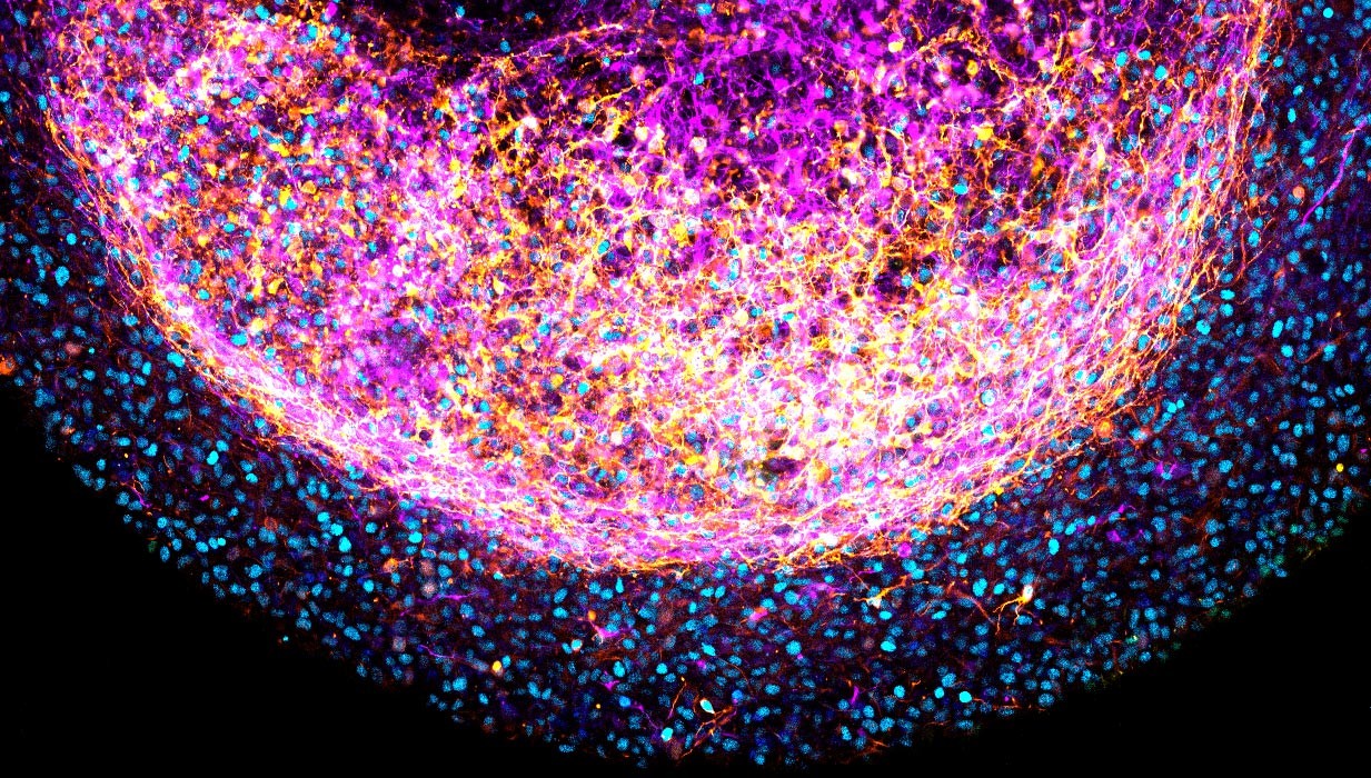 Część organoidu mózgowego powstałego z tkanki płodu /Fot. Princess Máxima Center

