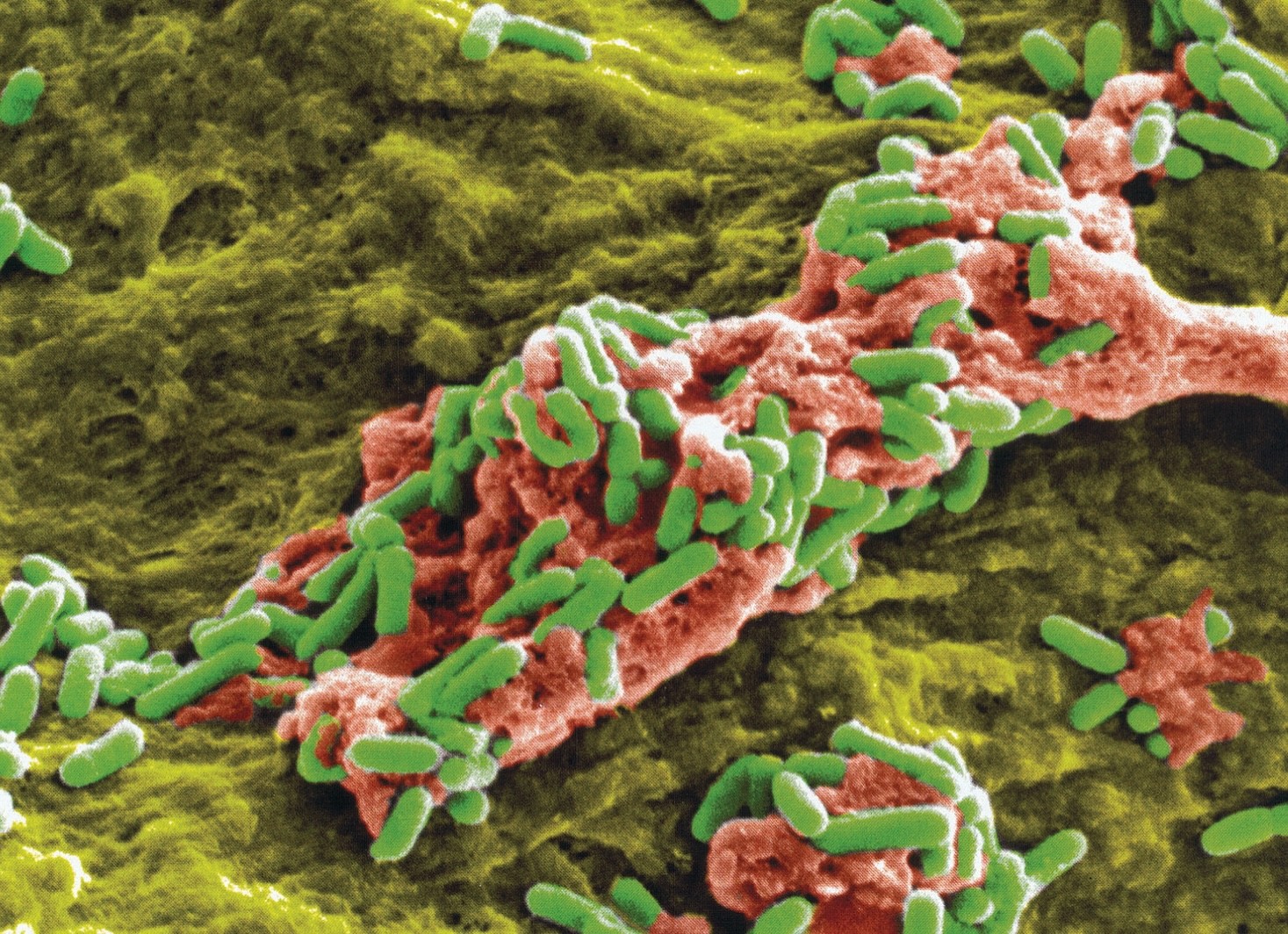 Bakteria Mycobacterium ulcerans /Fot. ASM Journals
