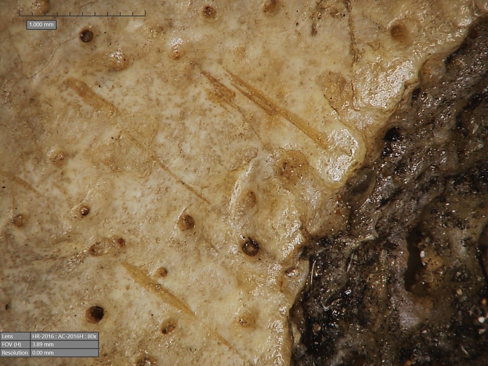 Prehistoryczna czaszka pokazuje coś niesamowitego o dawnej medycynie. Naukowcy zidentyfikowali zmiany