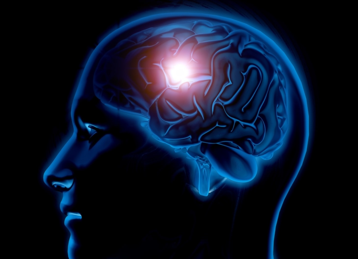 Wojna o nasze mózgi się rozpoczęła. Chiński implant kontra Neuralink Muska