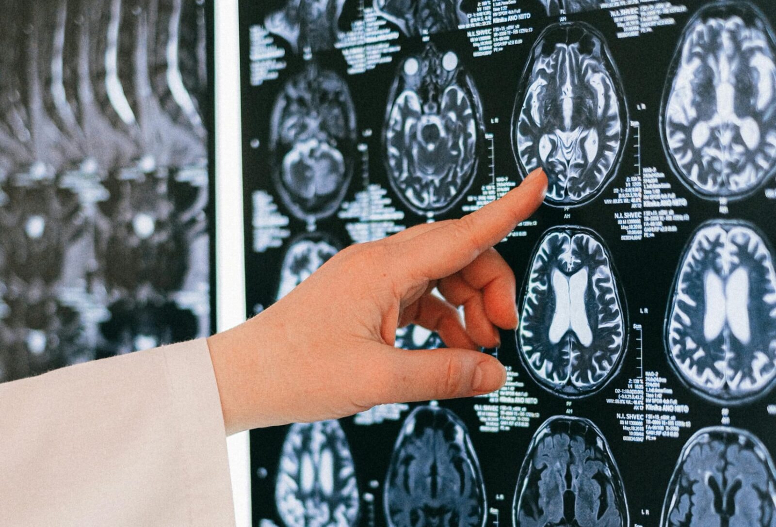 aktywność fizyczna pomaga zachować zdrowy mózg