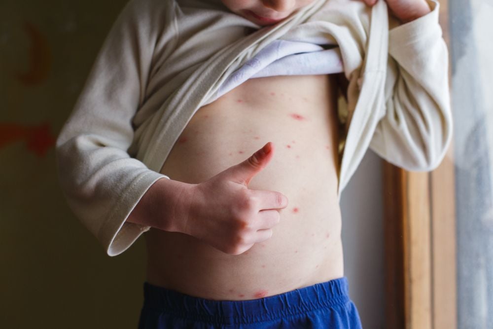 Coraz więcej rodziców nie szczepi dzieci. Co nam grozi? Epidemia. Za sześć lat