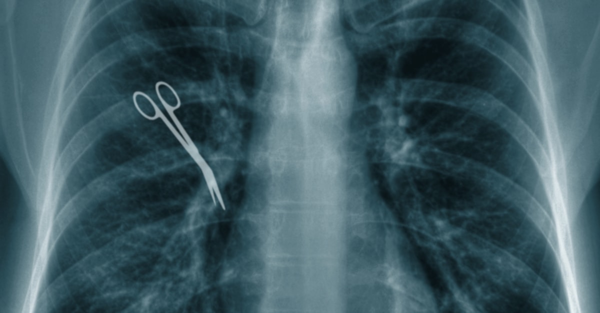 Gąbki, igły, nożyczki. Lekarze zostawiają w ciałach pacjentów tzw. pamiątki