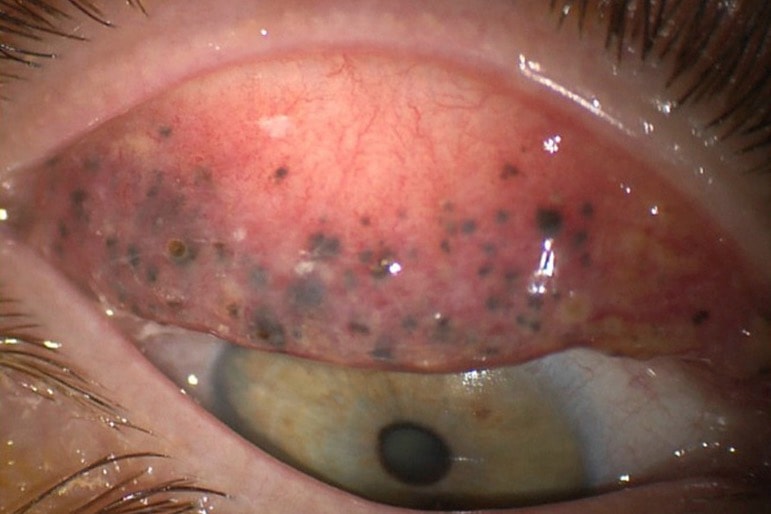 Używasz tuszu do rzęs? ZAWSZE pamiętaj, by go odpowiednio zmyć