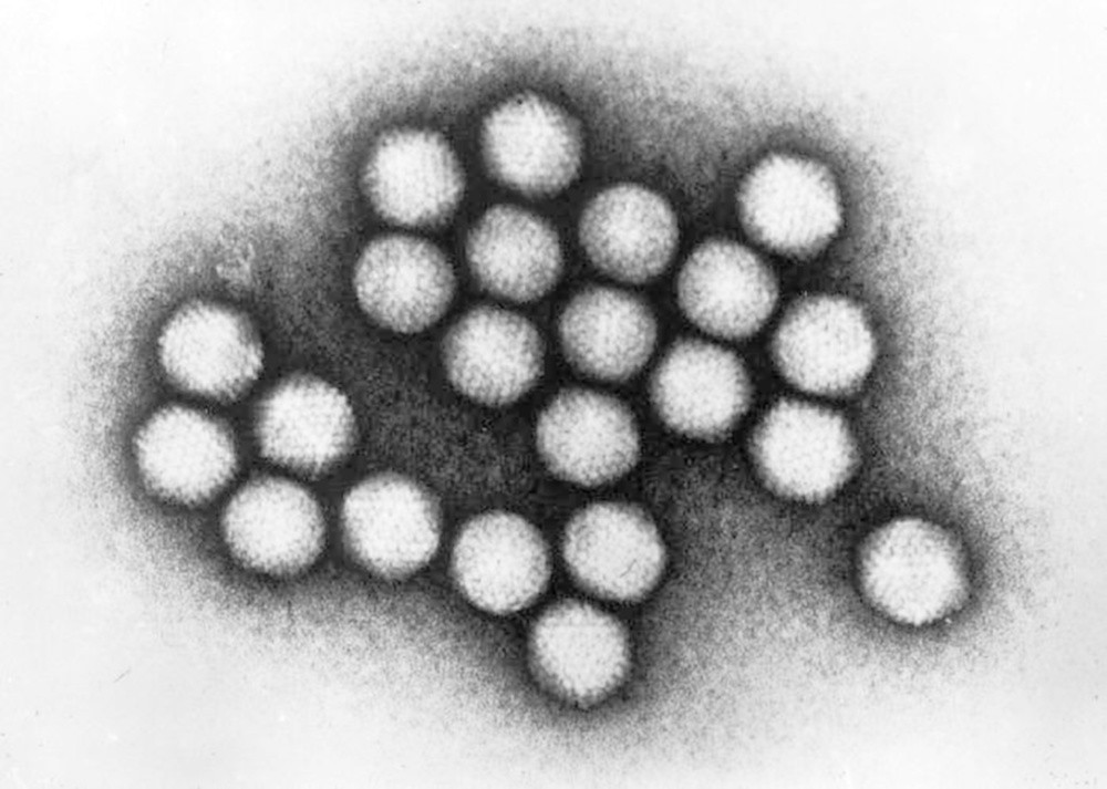 W USA zabił już 11 dzieci. Co musimy wiedzieć o adenowirusie?