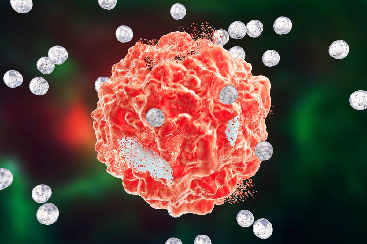 Komórka nowotworowa atakowana nanocząsteczkami

