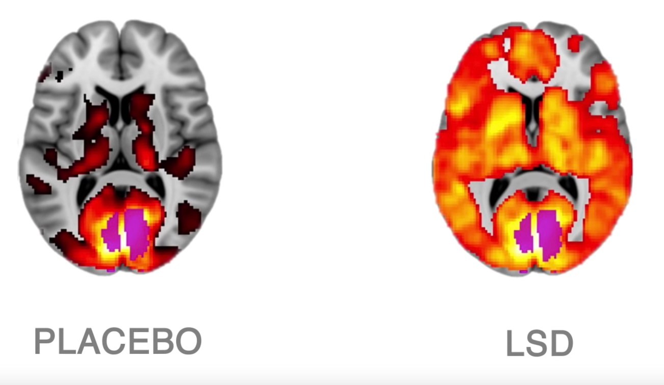 Znamy mechanizm działania LSD na mózg. Naukowcy: po narkotyku widzimy świat bez “filtrów”