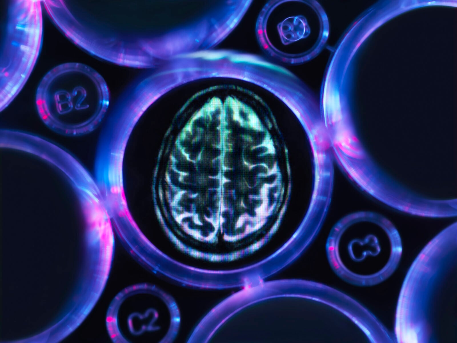 Antybiotyk lekiem na alzheimera? Wg badaczy w rozwoju choroby ma udział… bakteria