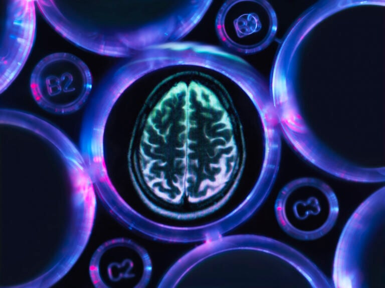 Antybiotyk lekiem na alzheimera? Wg badaczy w rozwoju choroby ma udział… bakteria