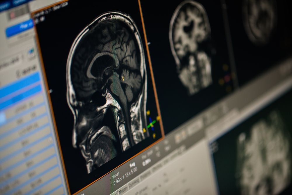 Do kiedy mózg tworzy nowe komórki? Nowe badanie daje dobre wiadomości