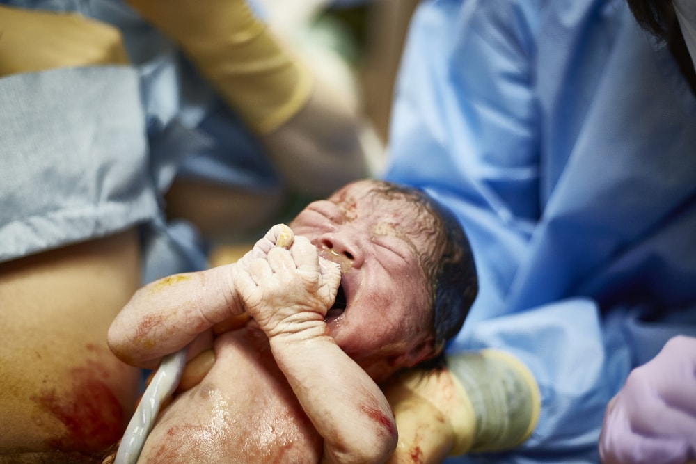 Jest związek między cesarskim cięciem a autyzmem. Nowe badanie