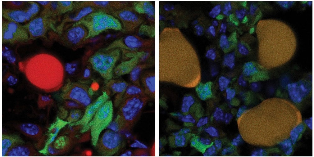 Naukowcy zmienili komórki rakowe w tłuszcz. “Nowotwór przestał się rozprzestrzeniać”