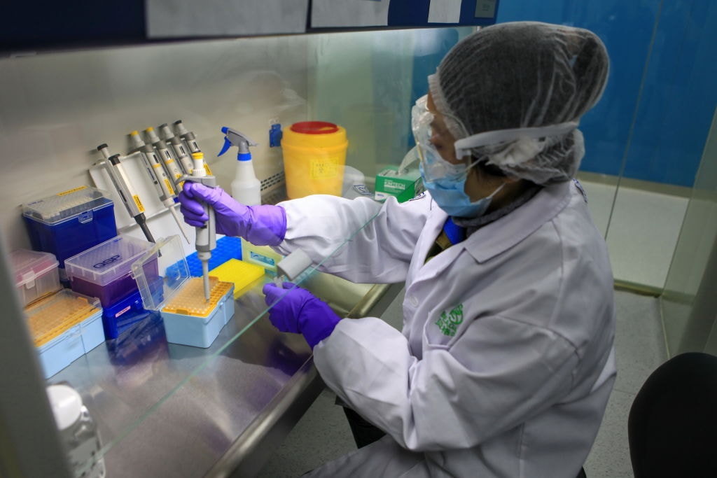 Koniec spiskowych teorii. Naukowcy udowodnili naturalne pochodzenie SARS-CoV-2