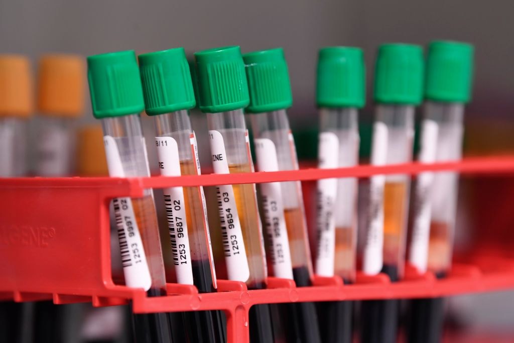 Nowy koronawirus mutuje, ale ”niegroźnie”. Rośnie nadzieja na uniwersalną szczepionkę