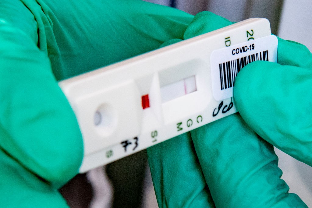 Test na obecność przeciwciał koronawirusa. Kto i kiedy powinien się mu poddać?