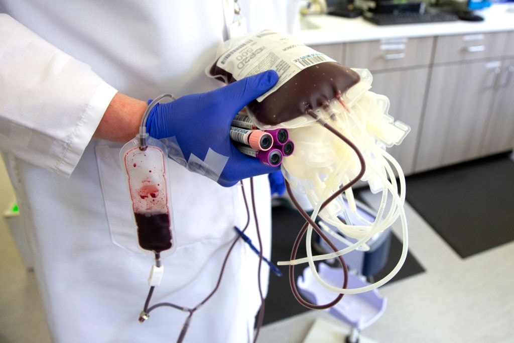 Terapia osoczem dopuszczona w leczeniu COVID-19. Ale nie u wszystkich