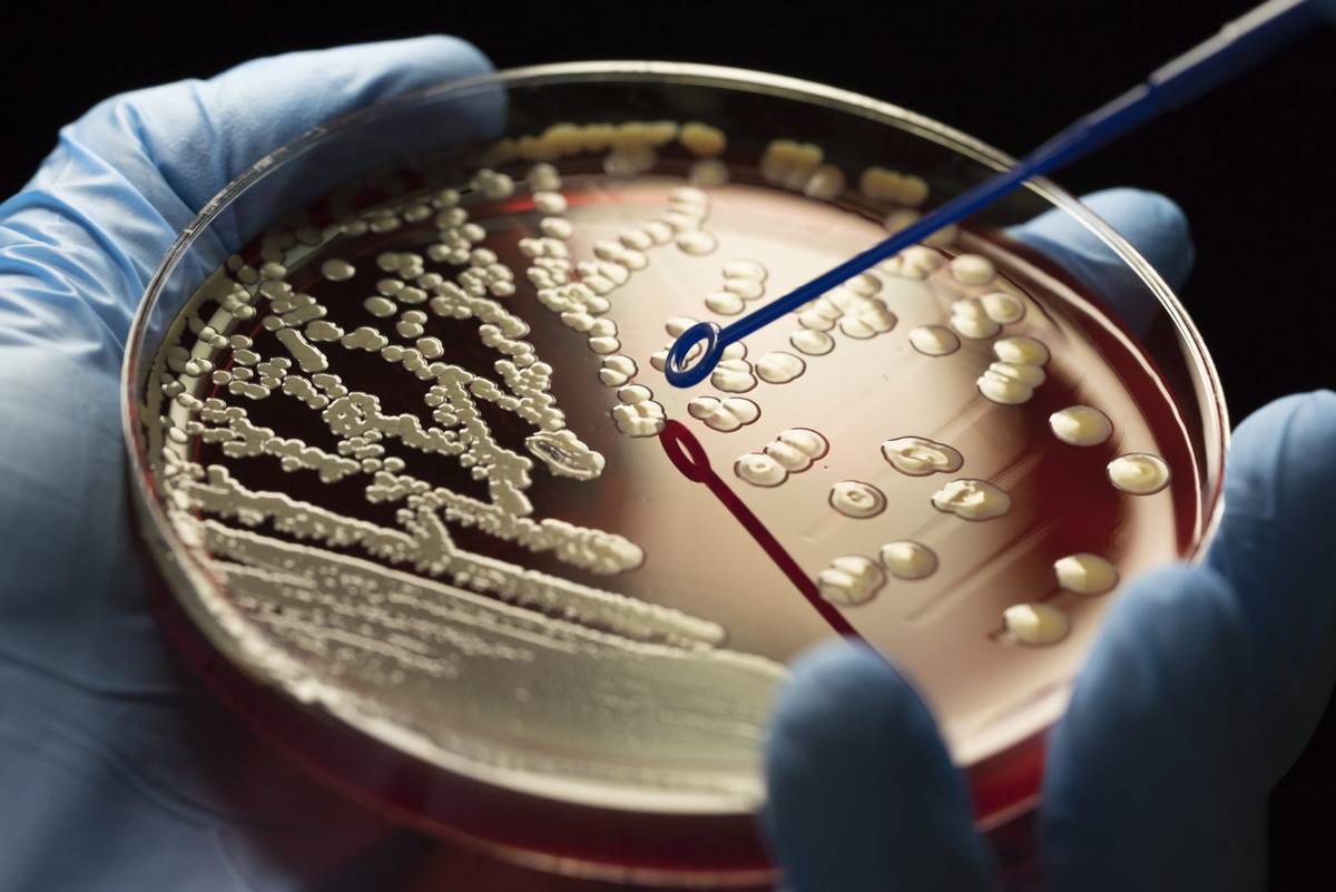 Dziwne formy witamin zwane “antywitaminami” zwalczają bakterie odporne na antybiotyki