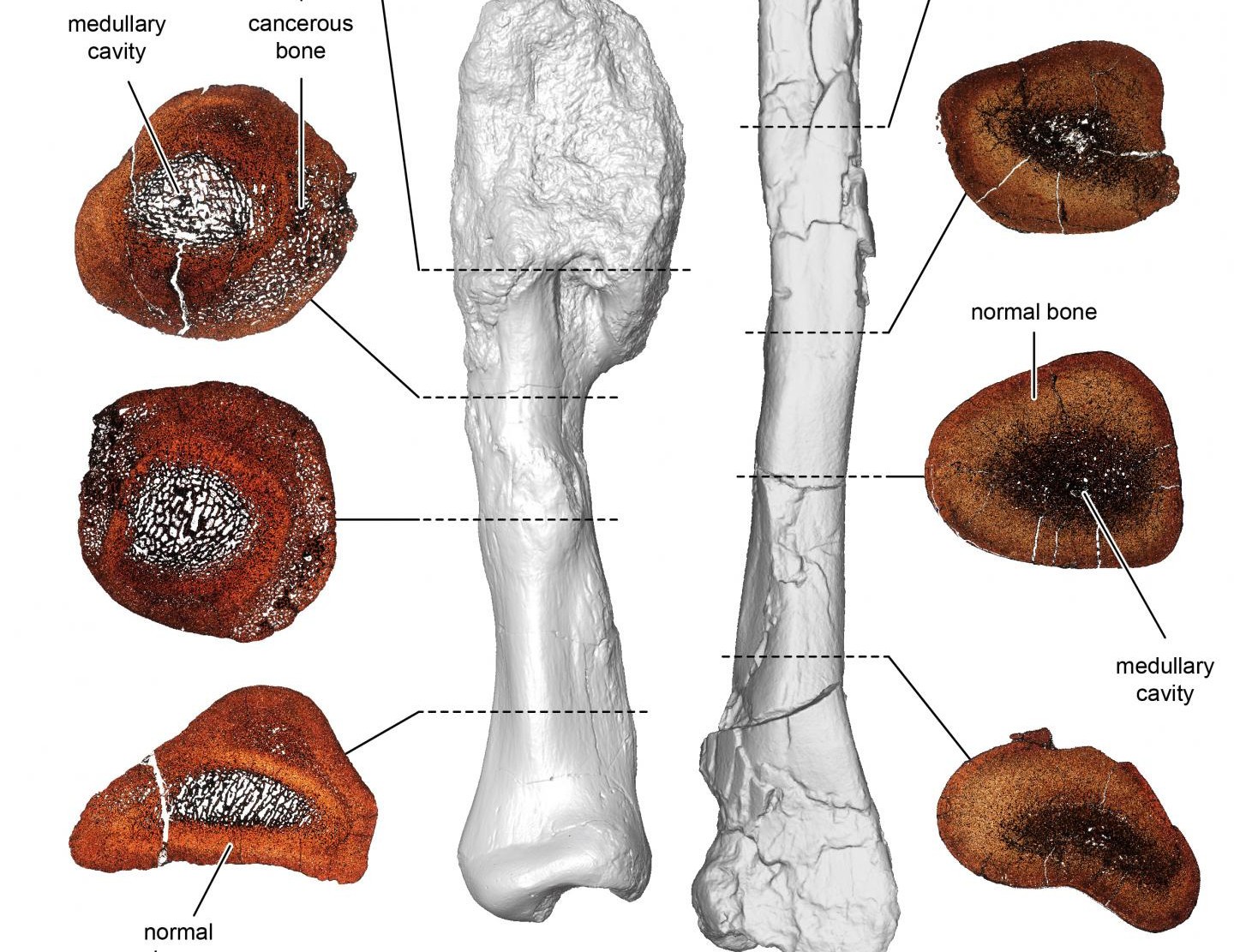 Nowotwór kości po raz pierwszy zdiagnozowany u dinozaura. W kości sprzed 76 mln lat