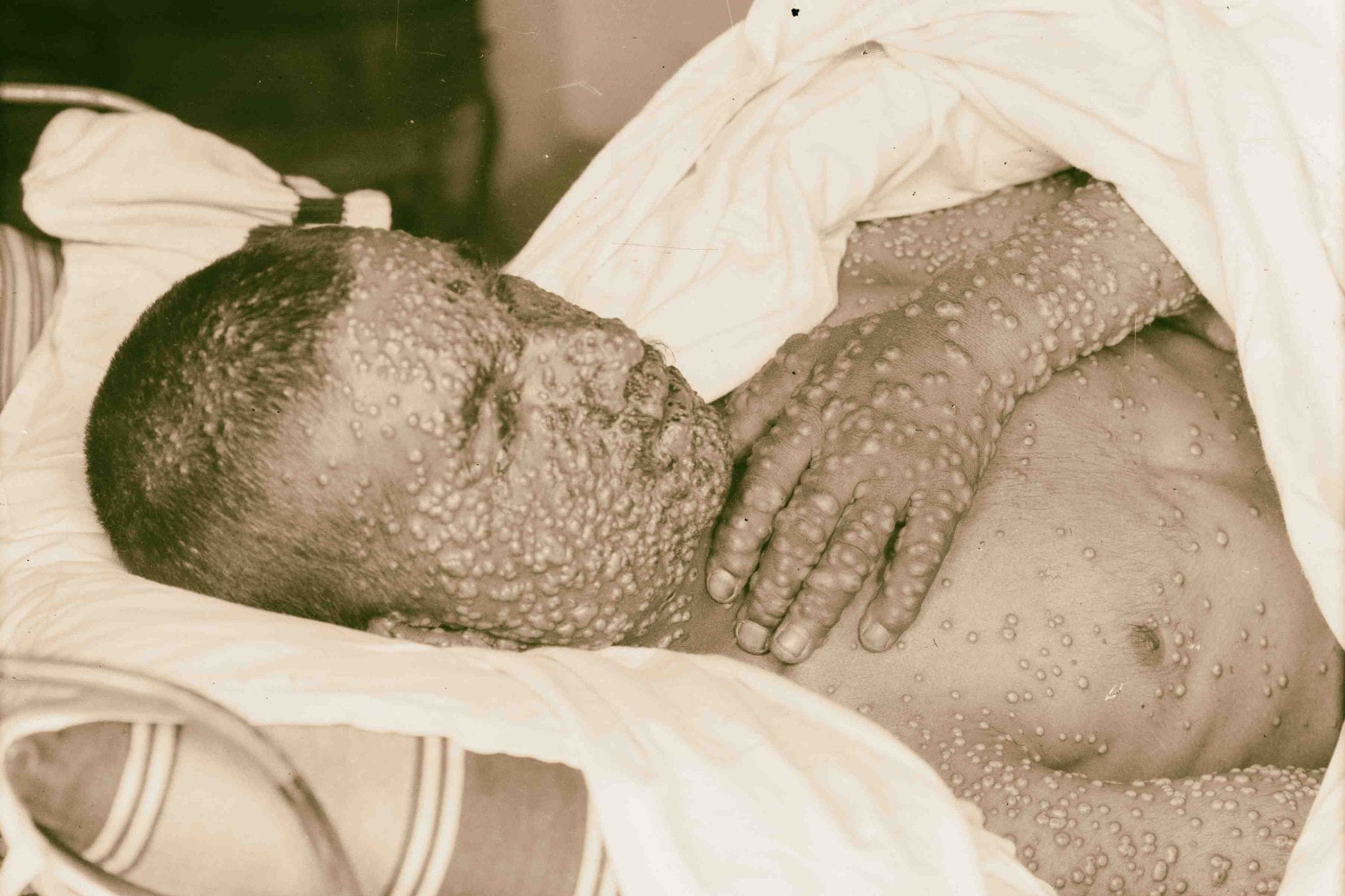 DNA zabójczej choroby znalezione w grobach wikingów sprzed 1400 lat