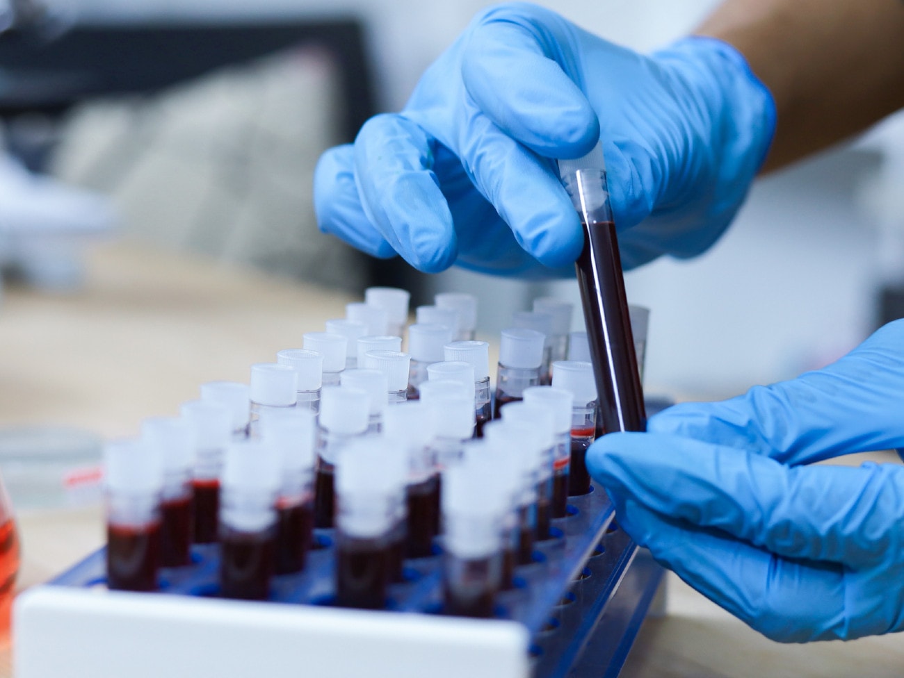 Polski lek na koronawirusa już w produkcji. Jako pierwszy na świecie