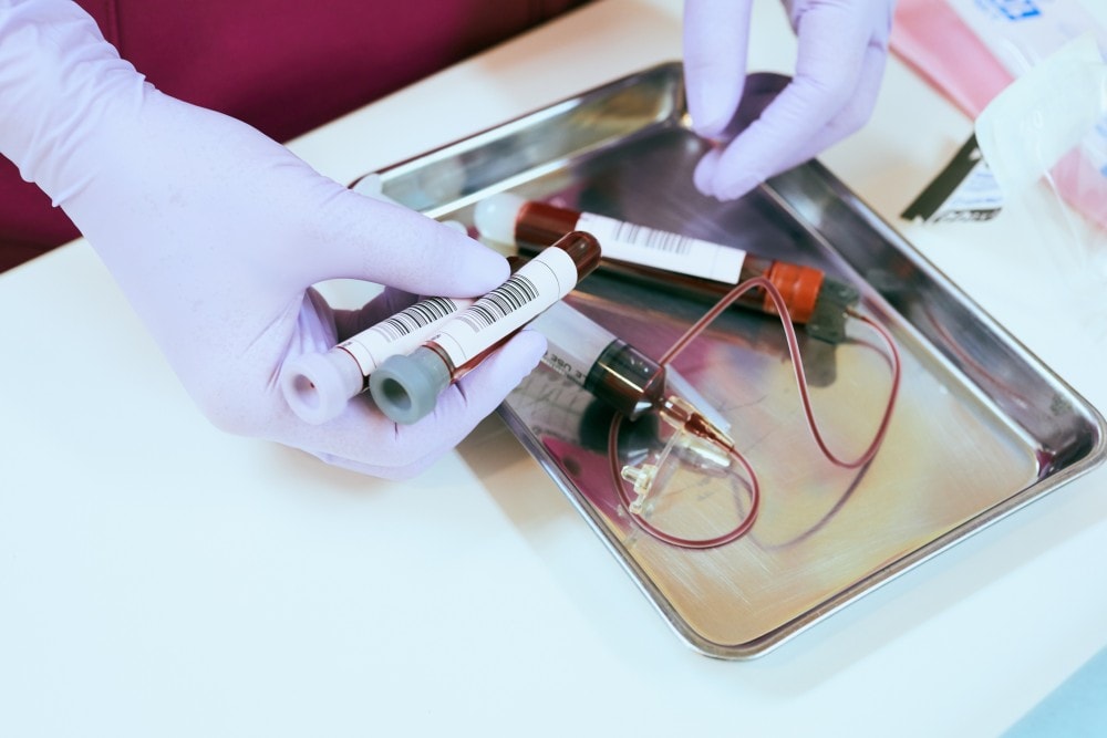 Rutynowe badanie krwi wykrywa zwiększone ryzyko zgonu na COVID-19