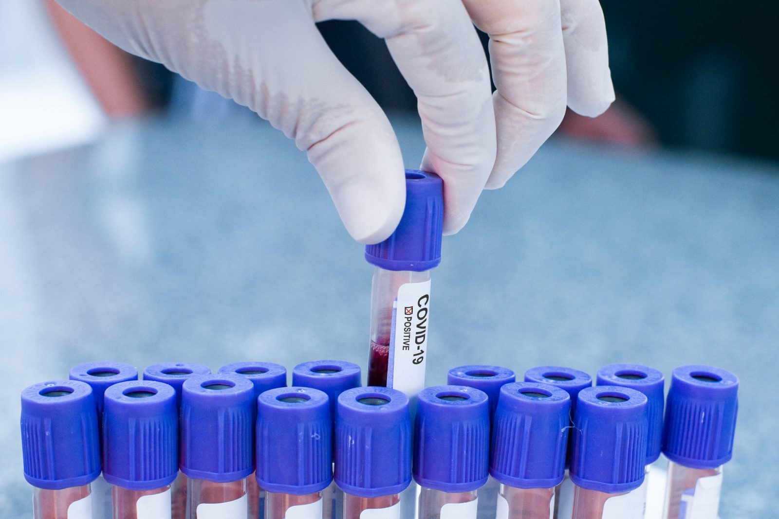 Chińska szczepionka  na koronawirusa bezpieczna. Obiecujące wyniki testów w Brazylii