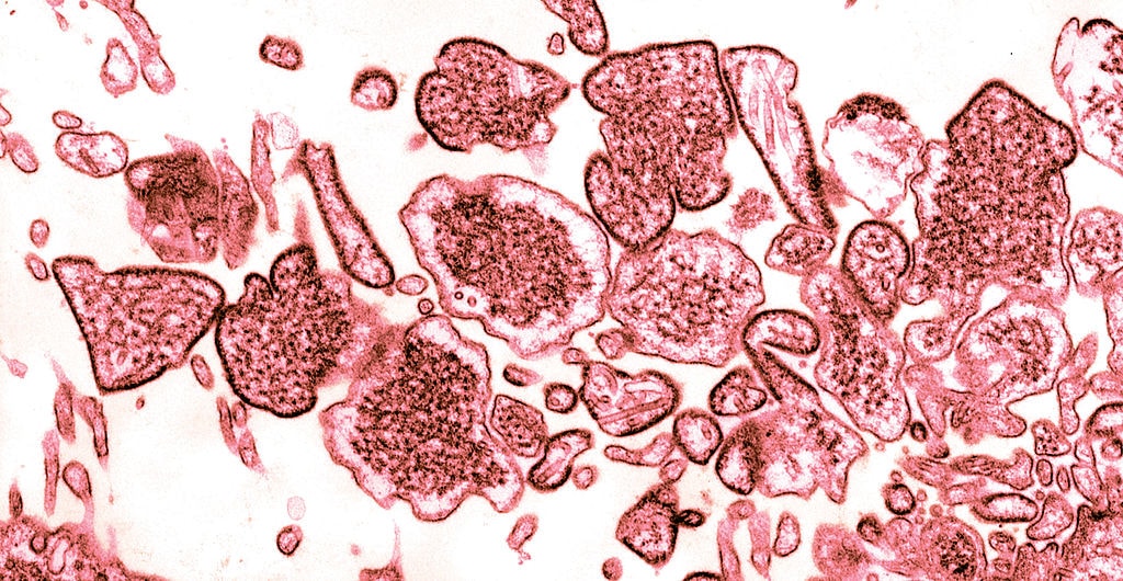 Eksperci ostrzegają przed wirusem Nipah. Może wywołać pandemię tragiczniejszą niż COVID