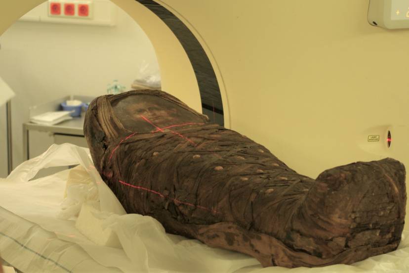 twarz-chlopca-zrekonstruowano-bez-otwierania-sarkofagu-image-c-nerlich-ag-et-al-plos-one-2020-cc-by-4-0